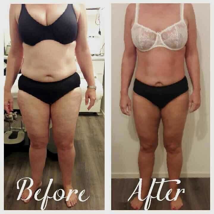 Ghadas Ideal Body | 3825 Pl. Nogent, Brossard, QC J4Y 2H2, Canada | Phone: (514) 746-2647