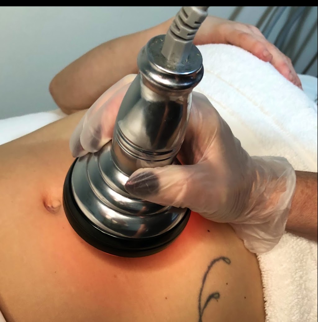 NuYou MedSpa + laser clinic | 671 Larry Uteck Blvd Suite 407, Bedford, NS B4A 4H4, Canada | Phone: (902) 422-7327