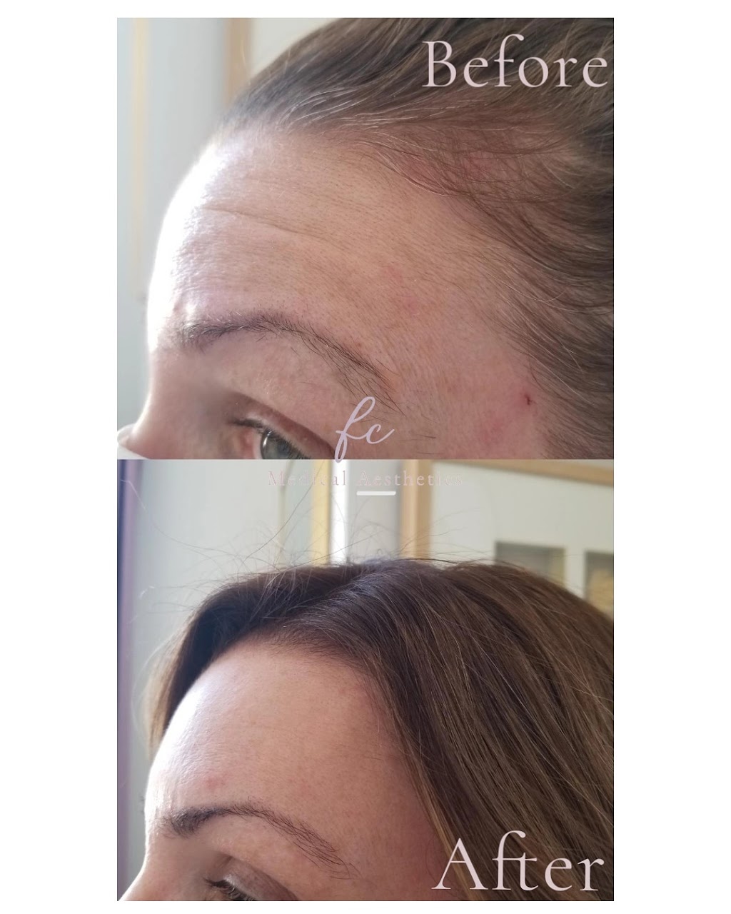 Aesthetics FC | 95 Brabin Cir, Whitby, ON L1P 0C2, Canada | Phone: (289) 200-0665