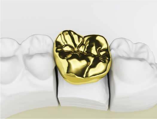 Creative Dental Ltd | 1780 Fort St, Victoria, BC V8R 1J5, Canada | Phone: (250) 595-1314