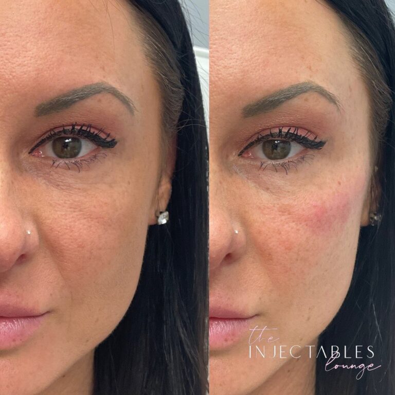 The Injectables Lounge | 190 Wortley Rd Unit 100C, London, ON N6C 4Y7, Canada | Phone: (226) 237-7446