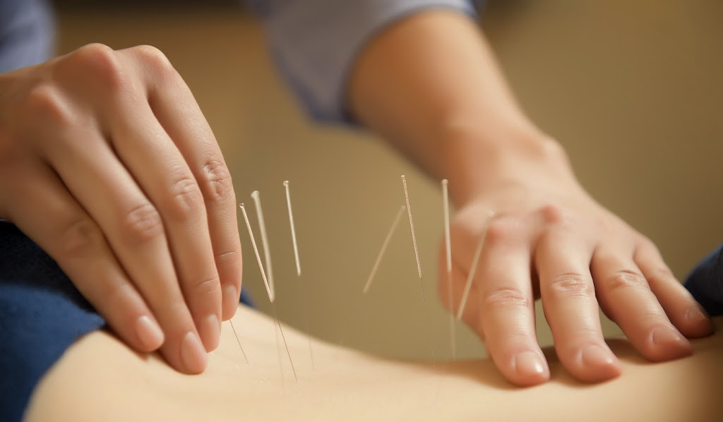 Off The Hook Laser and Spa | 30 Green Grove Dr, St. Albert, AB T8N 5H6, Canada | Phone: (780) 418-2003