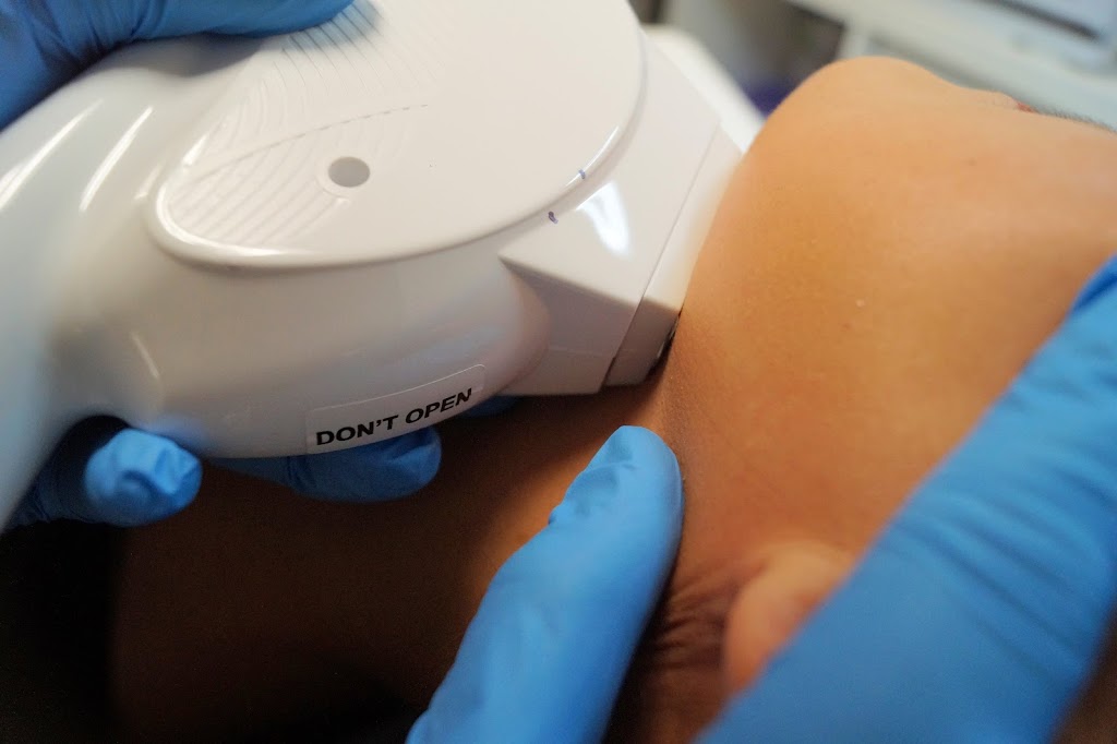 Oval Beauty Bar & Laser Clinic | 8 Weston Dr SW #43, Calgary, AB T3H 5P2, Canada | Phone: (587) 864-9955