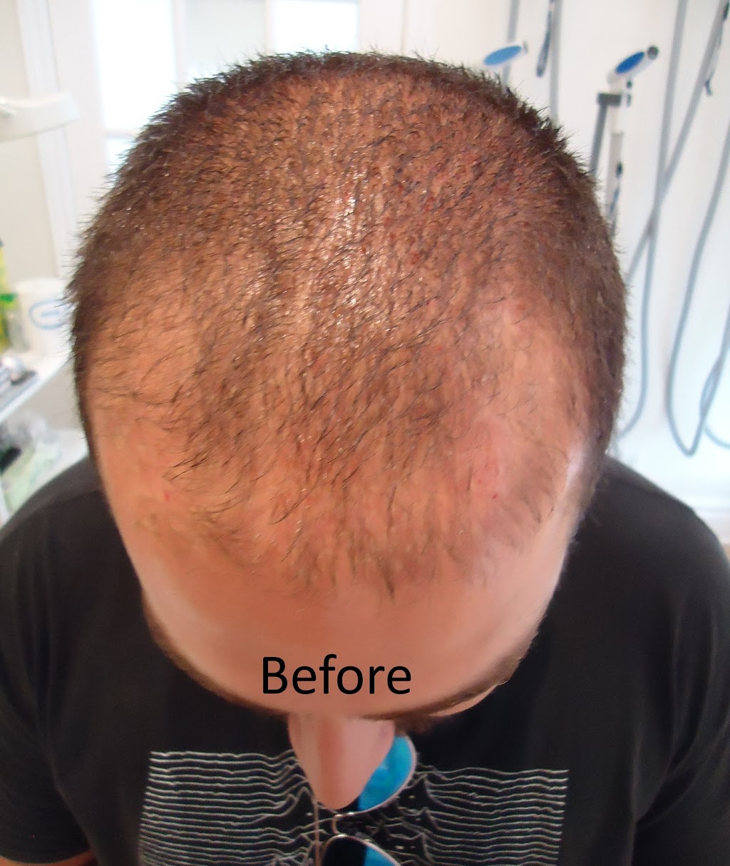 LightTouch Med Spa Oakville | 90 Reynolds St, Oakville, ON L6J 3K2, Canada | Phone: (905) 844-3400