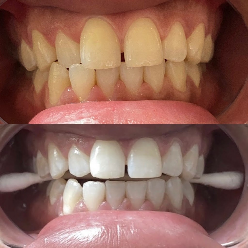 Blanche Smiles | 274 Markham Rd, Scarborough, ON M1J 3C5, Canada | Phone: (416) 885-1311