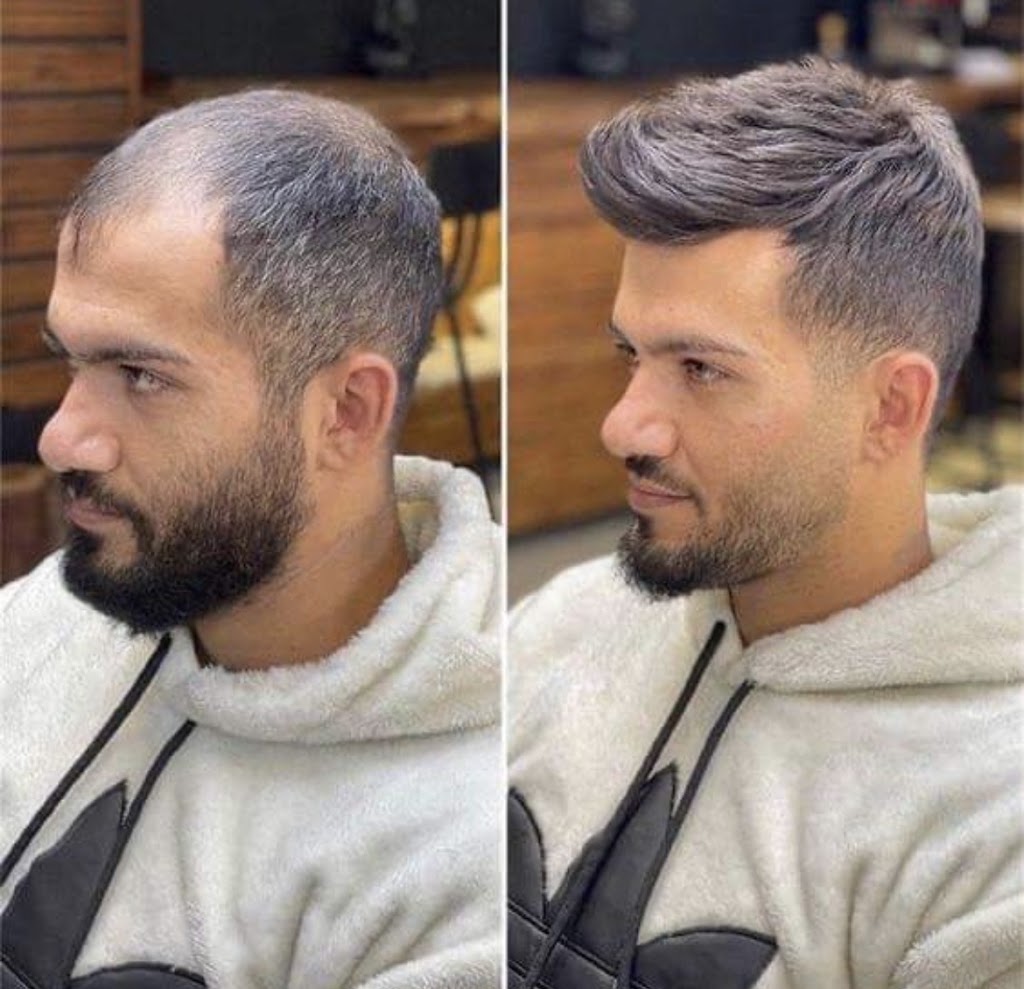 ProHair | 1112 Austin Ave unit 102 - B, Coquitlam, BC V3K 3P5, Canada | Phone: (778) 206-4247