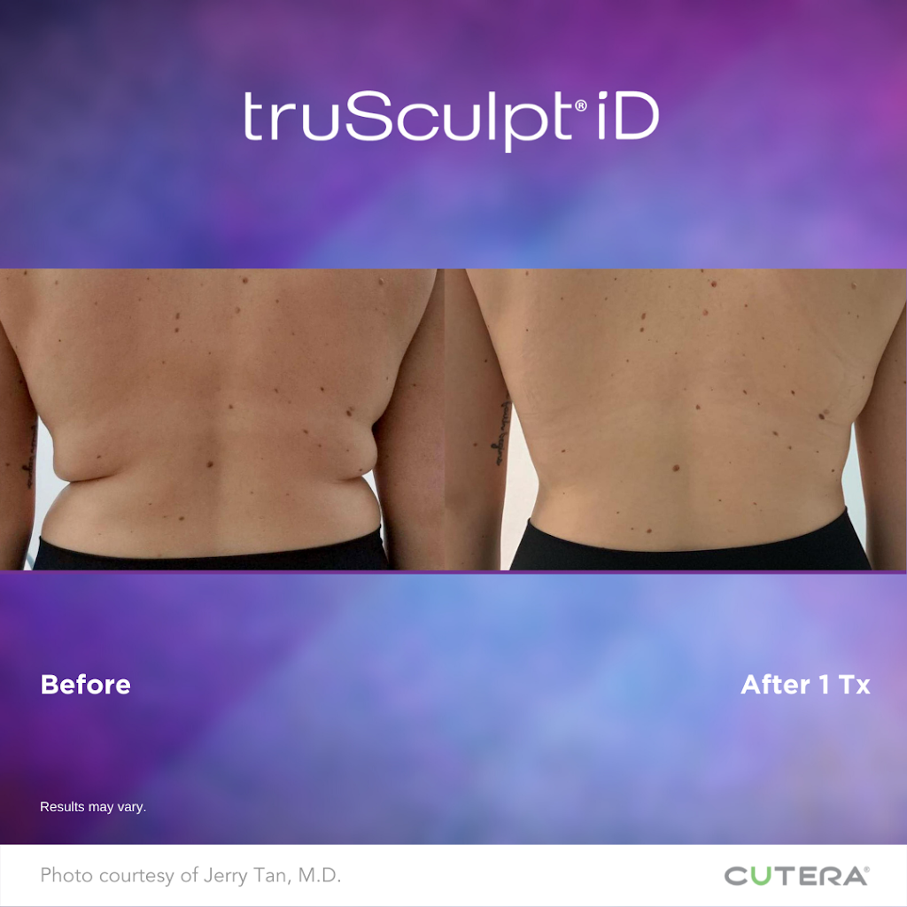The Body Architect | 194 Sherwood Mount Northwest, Calgary, AB T3R 0G5, Canada | Phone: (403) 354-0368
