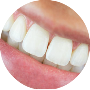 Expert Denture Clinic | 1050 Henderson Hwy #8, Winnipeg, MB R2K 2M5, Canada | Phone: (204) 334-0022