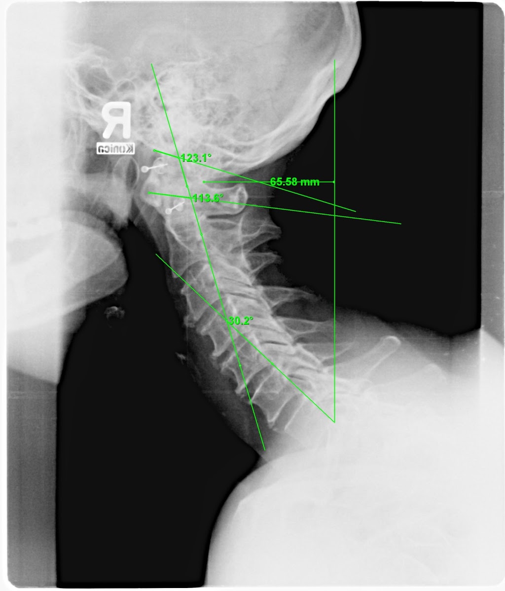 Academy Chiropractic Centre | 2-525 Academy Rd, Winnipeg, MB R3N 2A9, Canada | Phone: (204) 985-6750