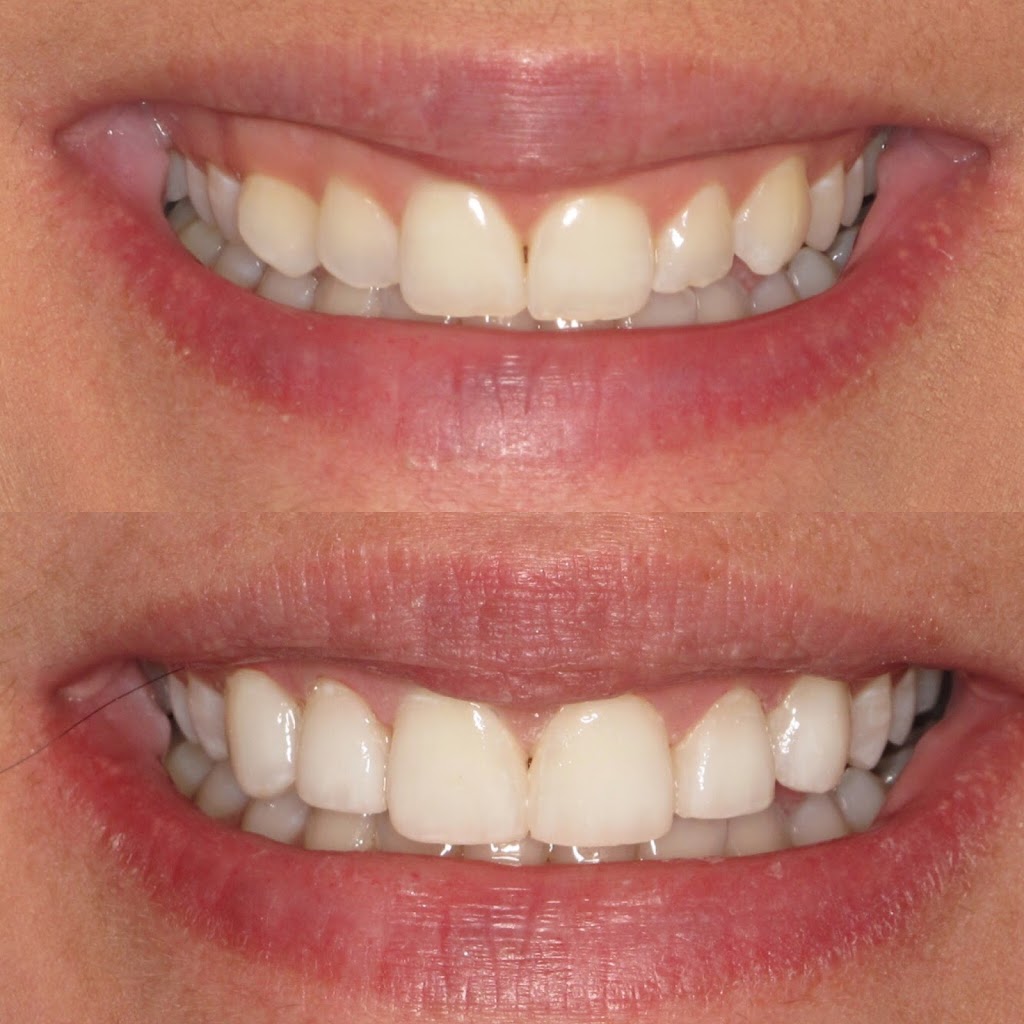 Woodbridge Vaughan Dental | 1160 Clarence St #4, Woodbridge, ON L4H 2V3, Canada | Phone: (905) 850-3443