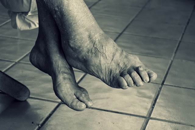 Active Foot Care Clinic & Orthotic Centre | 280 Queenston Rd #105, Hamilton, ON L8K 1H1, Canada | Phone: (905) 549-9974