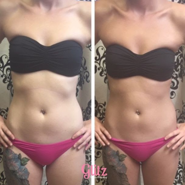 Glitz Spray Tanning | 1606 Sherwood Dr, Sherwood Park, AB T8A 1G5, Canada | Phone: (780) 691-8842
