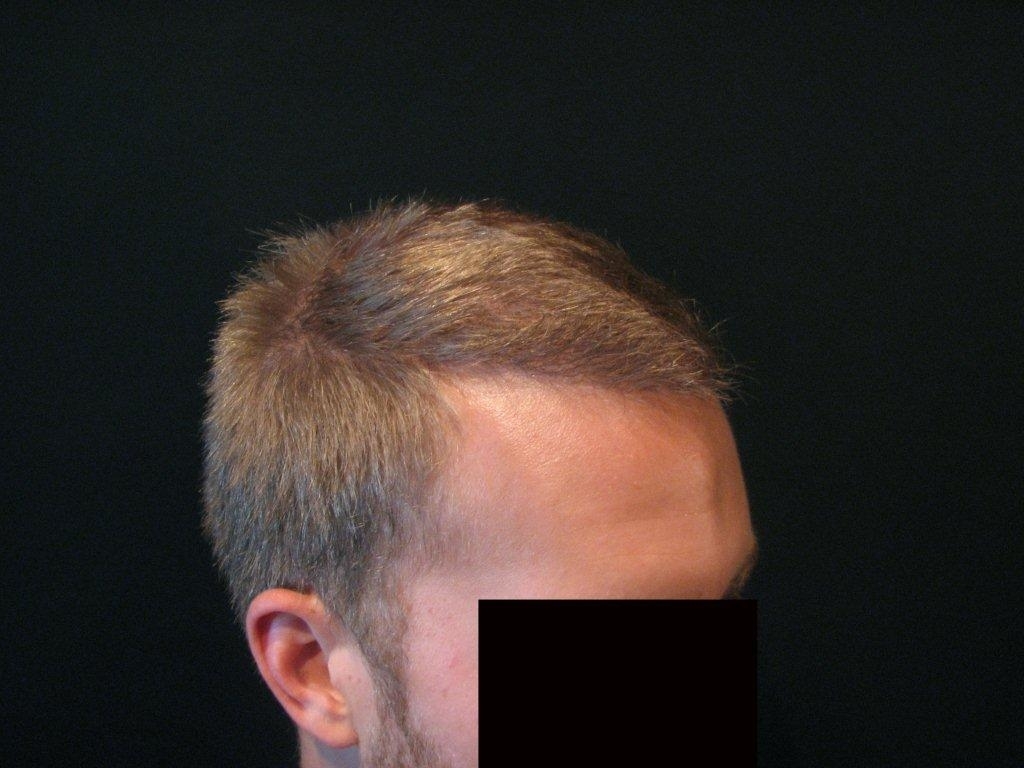 Dr Paul C Cotterill | 21 Bedford Rd, Toronto, ON M5R 2J9, Canada | Phone: (416) 322-0390