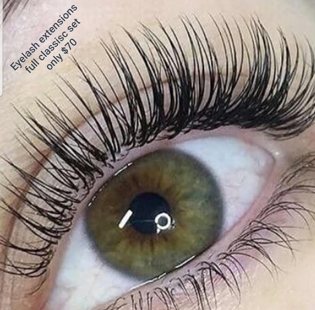 BellaDerma Perfect Skin Centre Inc. | 177 Rue Dolbeau St, Dieppe, NB E1A 8Y3, Canada | Phone: (506) 229-2585