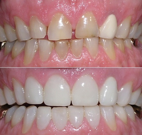 Tooth Care Centre | 6061 York Regional Rd 7, Markham, ON L3P 3B2, Canada | Phone: (905) 554-3555