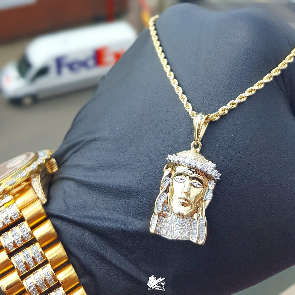 Gold Teeth Canada (Canadian Diamond Boyz Flagship) | 9664 106 Ave NW #305, Edmonton, AB T5H 0N4, Canada | Phone: (780) 935-4745