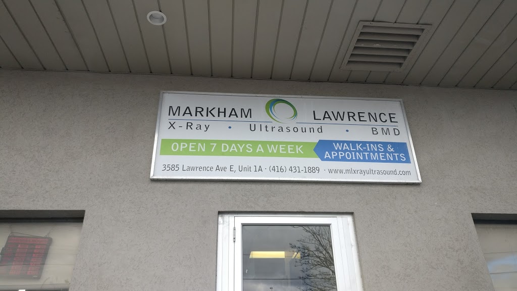 Markham-Lawrence X-Ray & Ultrasound | 3585 Lawrence Ave E #1-A, Scarborough, ON M1G 1P4, Canada | Phone: (416) 431-1889