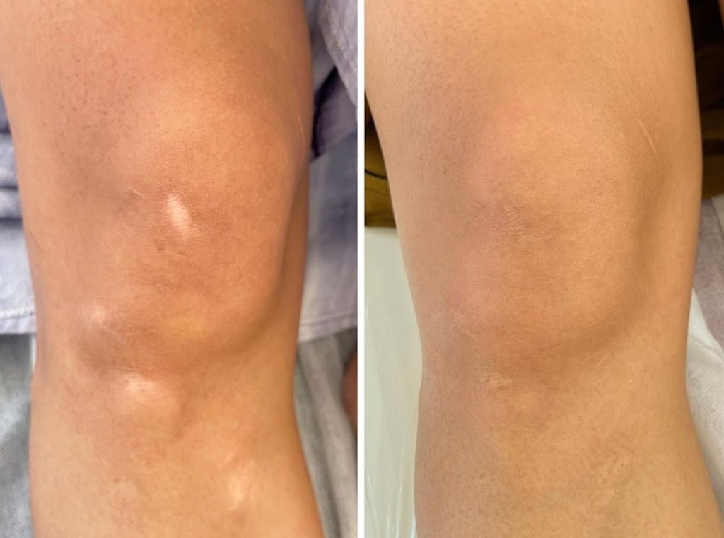 Efface Skin Care Clinic Inc. | 72 King St W, Stoney Creek, ON L8G 1H8, Canada | Phone: (905) 745-4097