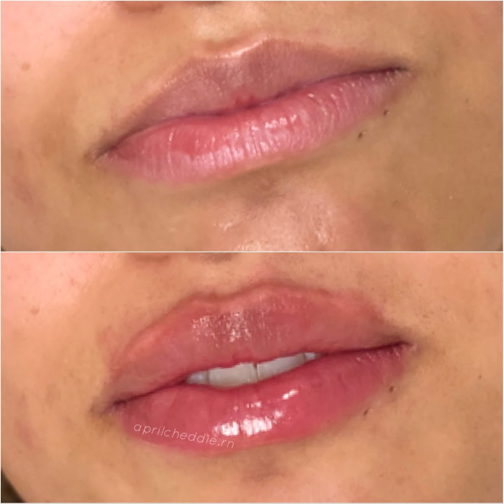 SkinScience Medical Esthetics Clinic | 58 Highland Rd Suite 2, Moose Jaw, SK S6J 1M5, Canada | Phone: (306) 692-2179
