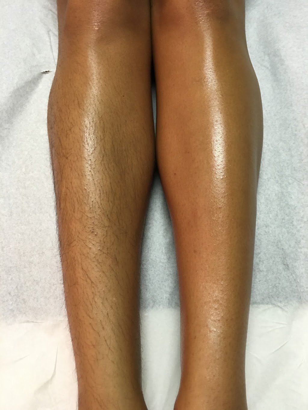 Just Wax | 588 Griesbach Parade NW Suite 101, Edmonton, AB T5E 6W9, Canada | Phone: (780) 720-8743