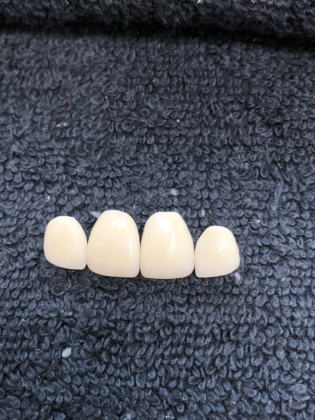 Proceram Dental Arts | 203-34654 Delair Rd, Abbotsford, BC V2S 2C9, Canada | Phone: (604) 853-7793