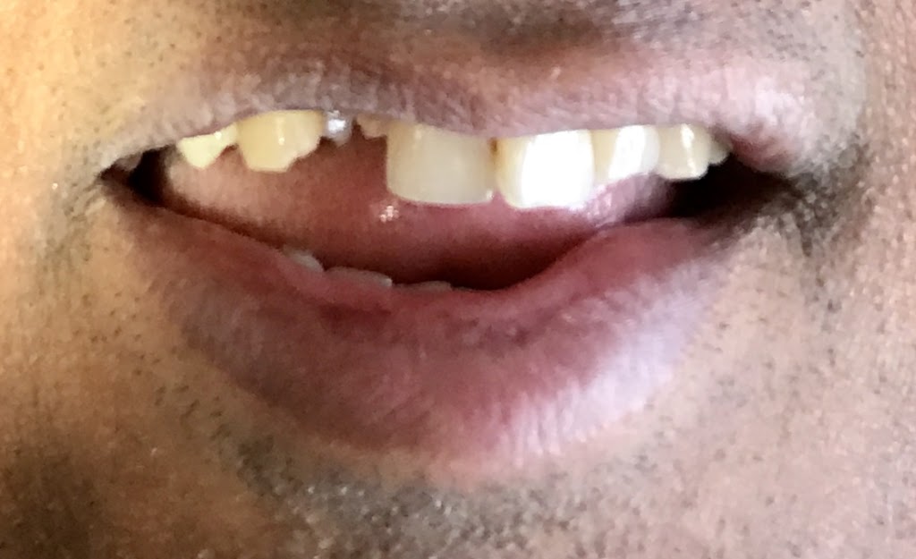 Dr. Meera Gopalkrishnan | 2190 Warden Ave suite 205, Scarborough, ON M1T 1V6, Canada | Phone: (416) 491-9993