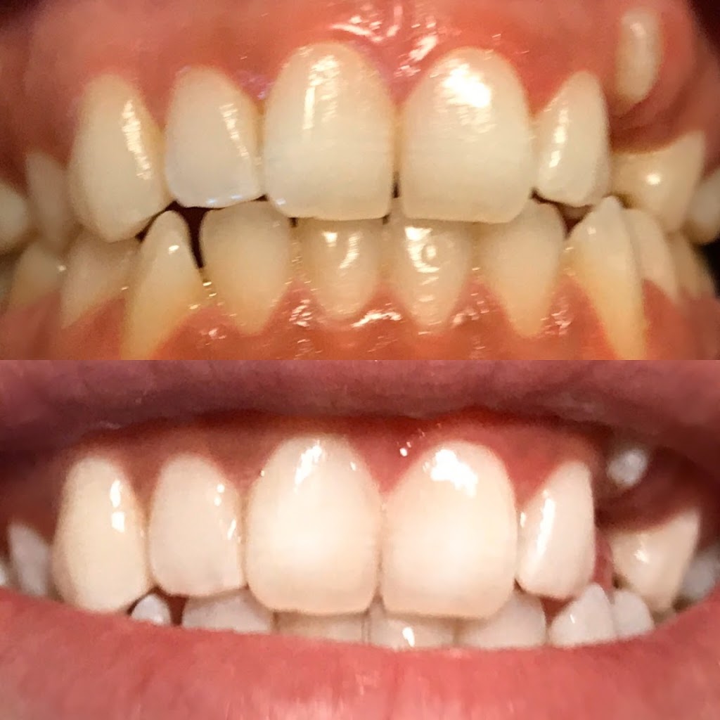 JJAesthetics | 164 Yellow Birch Dr, Kitchener, ON N2N 2N6, Canada | Phone: (519) 498-8601