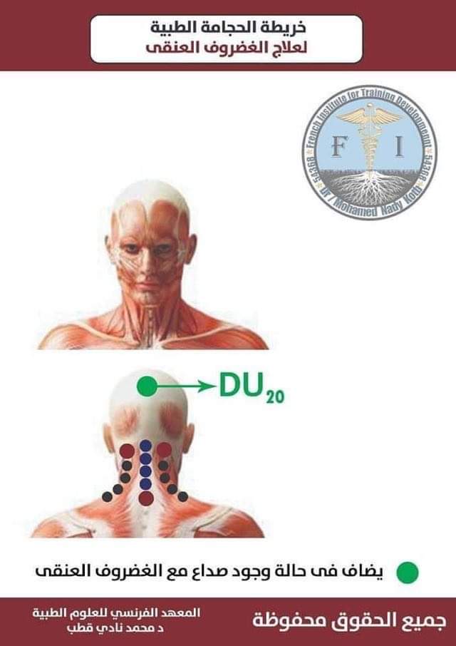 Hijama montreal clinic | 5805 Rue Lauzon, Montréal-Nord, QC H1G 2G9, Canada | Phone: (438) 221-5070