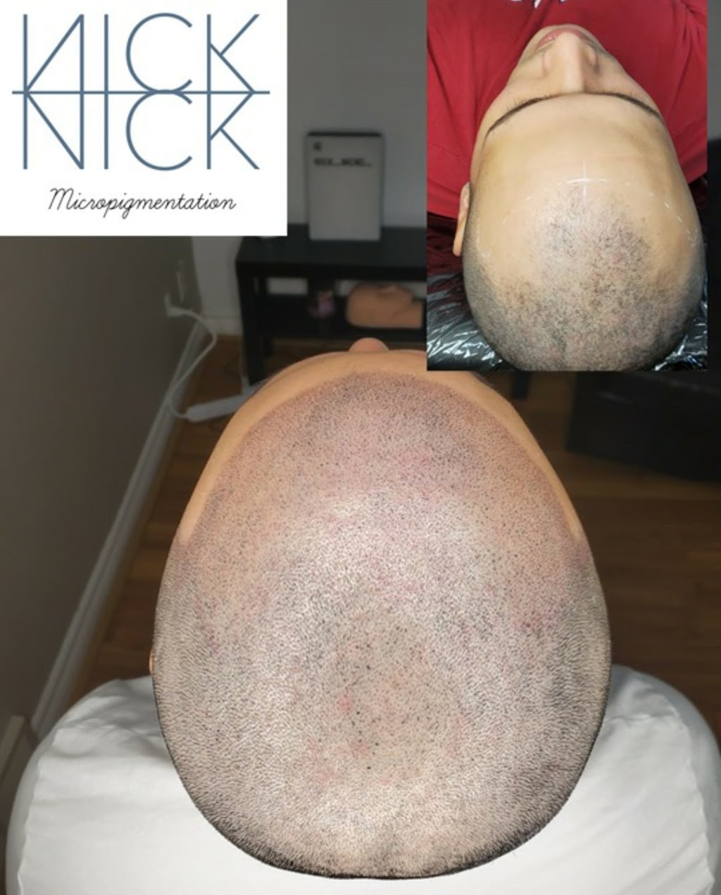 Nick Micropigmentation | 6150 Valley Way Unit A118, Niagara Falls, ON L2E 1X9, Canada | Phone: (289) 321-2183