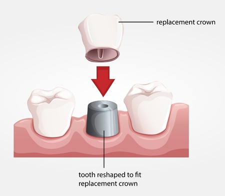 Dr. Davidson’s Dental Office | 1450 Centre St #2, Thornhill, ON L4J 3N1, Canada | Phone: (905) 707-8644
