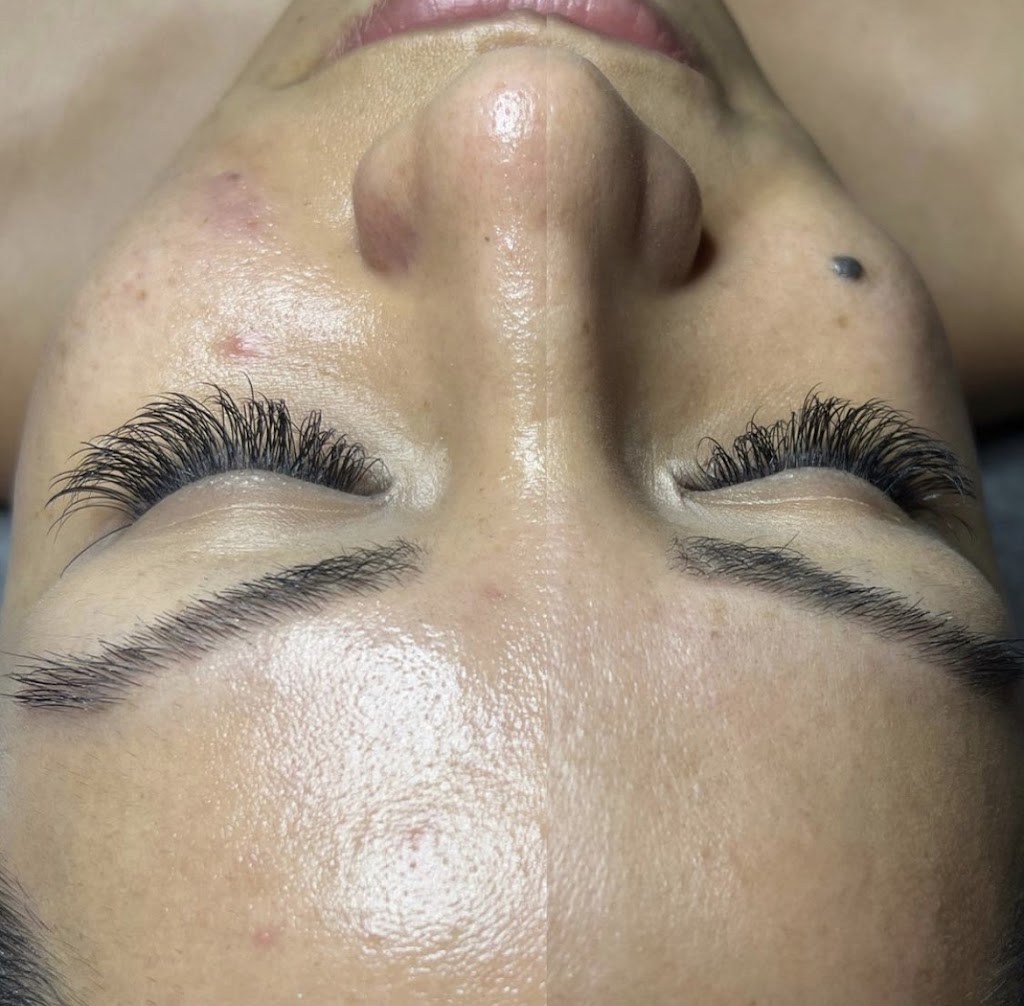 Clinique bē | 2020 Rue André-Labadie local 110, Beloeil, QC J3G 0W6, Canada | Phone: (438) 855-4717