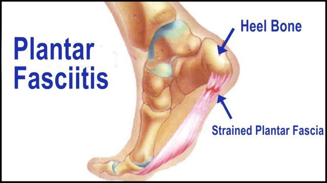 Foot by Foot Guelph West-Darlene Rempel-Certified Pedorthist | 130 Silvercreek Pkwy N, Guelph, ON N1H 7Y5, Canada | Phone: (519) 763-1918