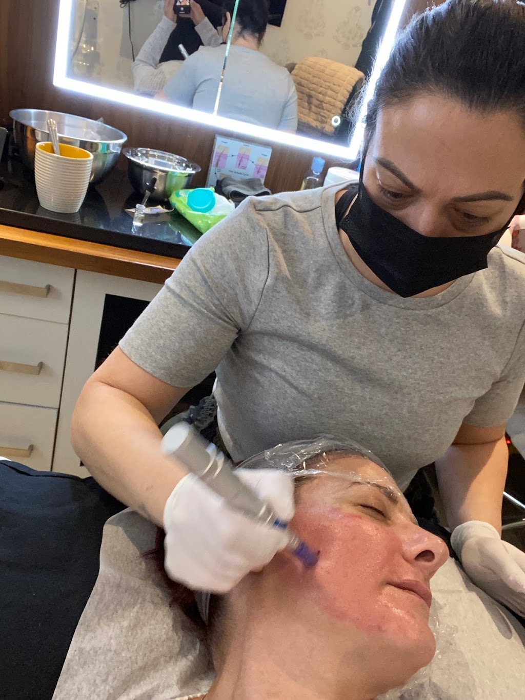 Universal Laser Treatments Inc | 16 Longhouse St, Vaughan, ON L4L 4Z3, Canada | Phone: (647) 278-2211