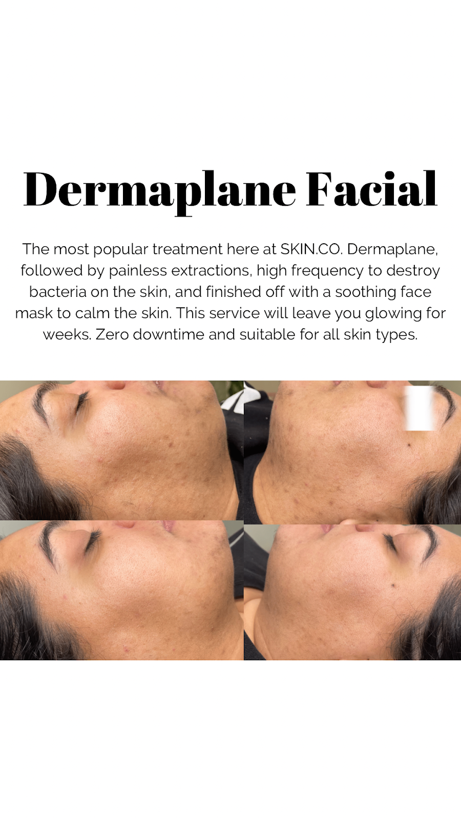SKIN.CO | 4515 Macleod Trail SW #1008, Calgary, AB T2G 2R5, Canada | Phone: (403) 978-5567