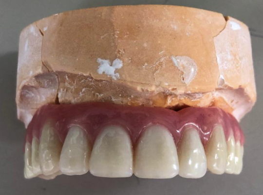 Innovative Dental Laboratories | 1706 Danforth Ave, Toronto, ON M4C 1H8, Canada | Phone: (416) 463-3138