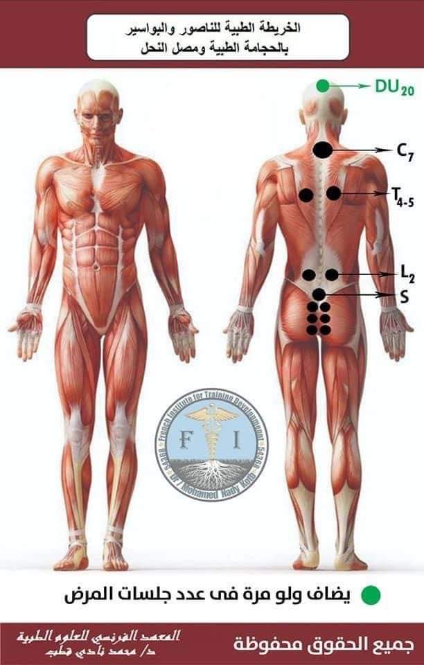 Hijama montreal clinic | 5805 Rue Lauzon, Montréal-Nord, QC H1G 2G9, Canada | Phone: (438) 221-5070