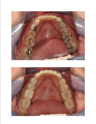 Clinique Dentaire Dac - Dentiste Westmount | 4141 Rue Sherbrooke Ouest #350, Westmount, QC H3Z 1B7, Canada | Phone: (514) 934-0748