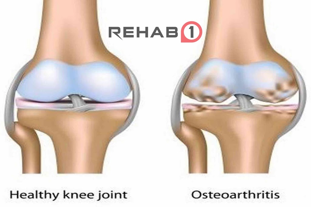 Rehab1 Performance Center Riverview | 639 Pinewood Rd #102, Riverview, NB E1B 5R6, Canada | Phone: (506) 854-1151
