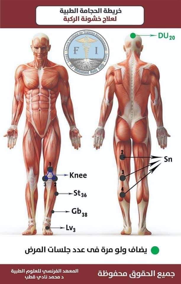 Hijama montreal clinic | 5805 Rue Lauzon, Montréal-Nord, QC H1G 2G9, Canada | Phone: (438) 221-5070