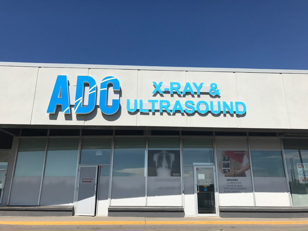ADC X-Ray & Ultrasound | 3301 17 Ave SE #20, Calgary, AB T2A 0R2, Canada | Phone: (587) 351-9729