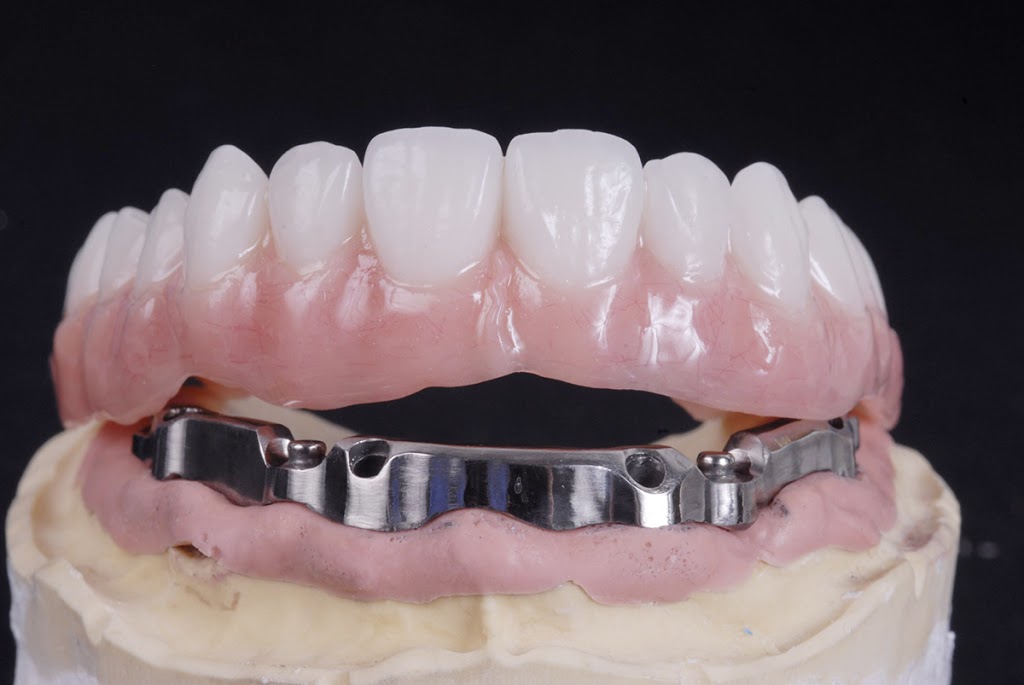 SkyCAD Dental Technology Ltd. (Dental Lab) | 1638 10 Ave SW, Calgary, AB T3C 0J5, Canada | Phone: (403) 970-0600