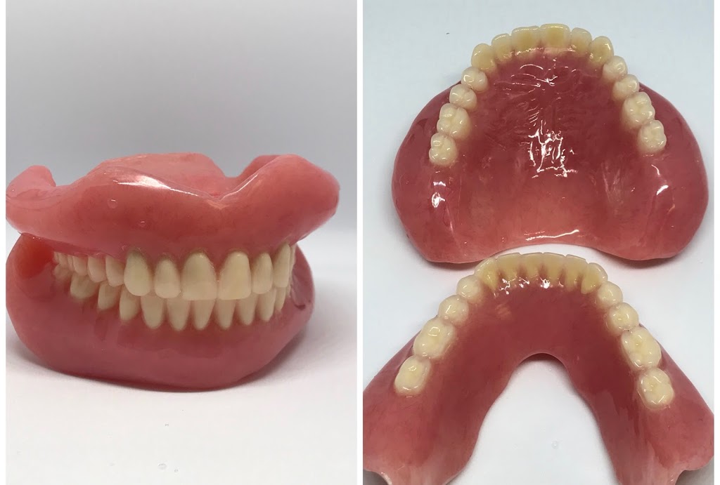 Kasper Denture clinic ltd | 1710 Ellis St Suite 25, Kelowna, BC V1W 3S9, Canada | Phone: (250) 717-3730