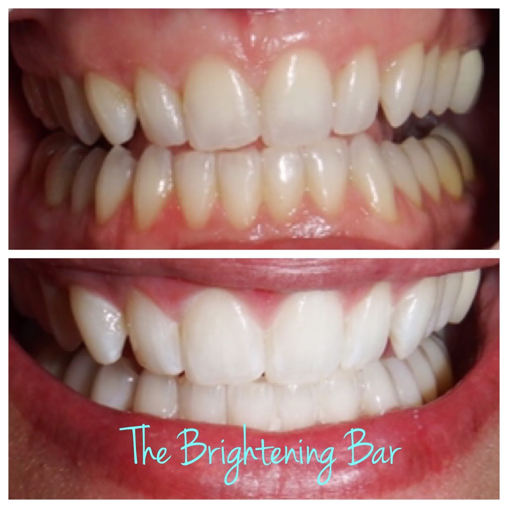 The Brightening Bar | 13012 Victoria Rd N, Summerland, BC V0H 1Z50, Canada | Phone: (250) 859-5952