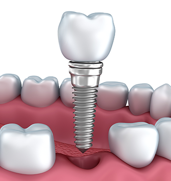 Savannah Dental Clinic | 1715 102 St NW, Edmonton, AB T6N 0B1, Canada | Phone: (780) 784-8284