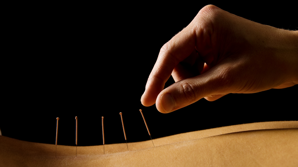 Di Wu Acupuncture | 3091 152 St Unit 310, Surrey, BC V4P 3K1, Canada | Phone: (604) 591-5569