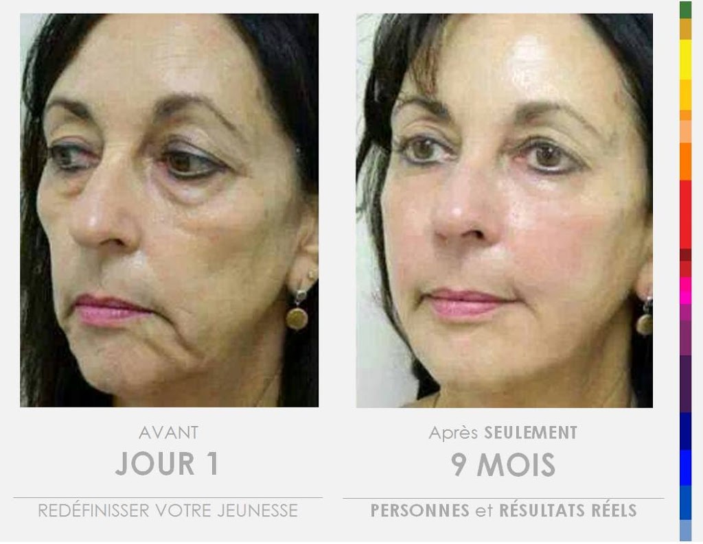 evolution beaute | 1172 Rue Saint Louis, Saint-Jean-Chrysostome, QC G6Z 2L2, Canada | Phone: (418) 956-9488