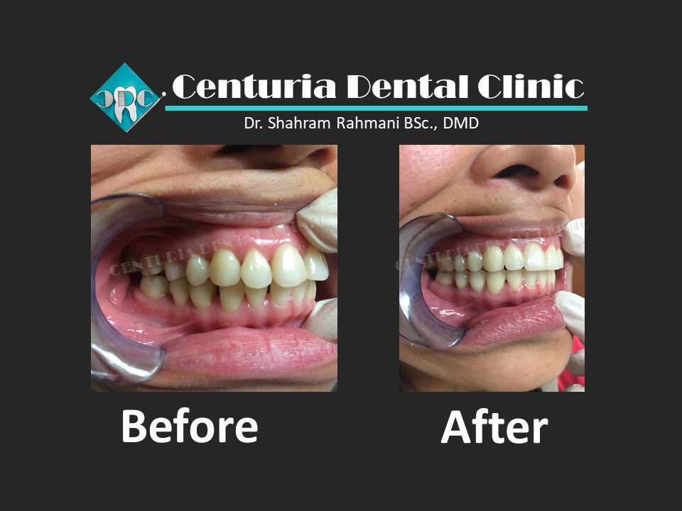 Centuria Dental Clinic | 5-1131 Lawson Ave, Kelowna, BC V1Y 6T8, Canada | Phone: (236) 420-0210