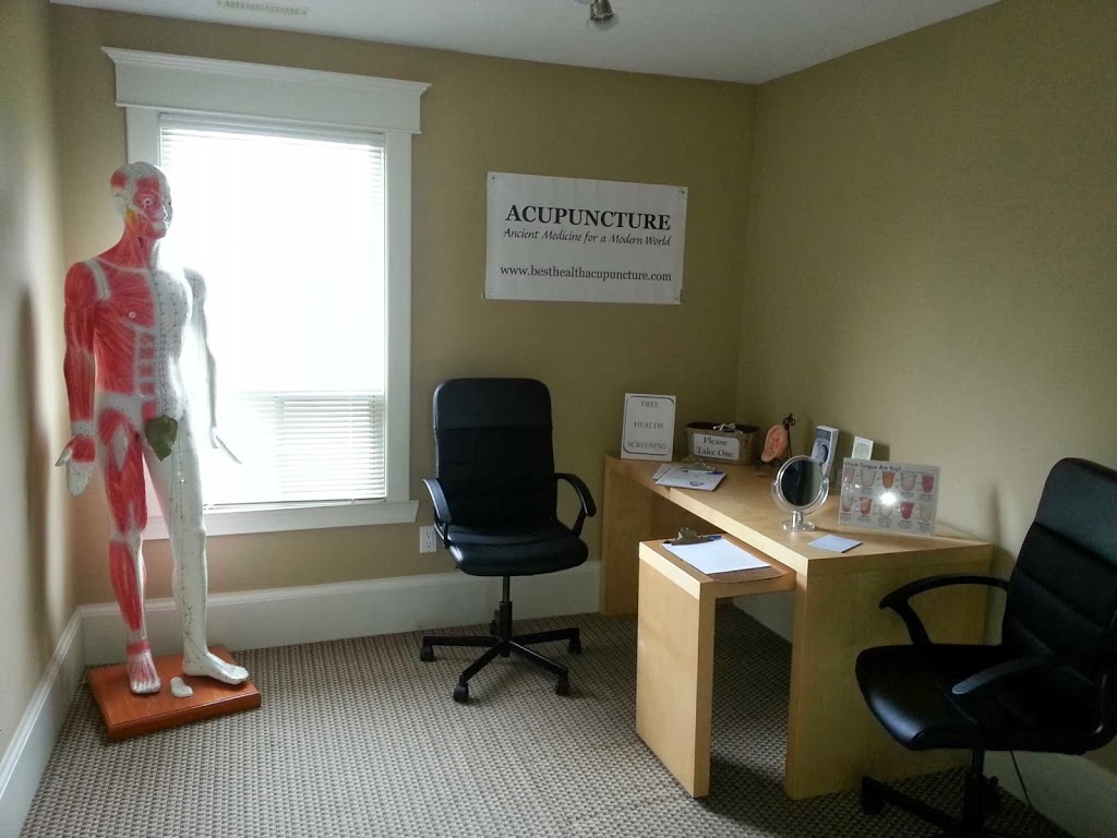 Best Health Acupuncture Clinic - Vaughan | 2174 Major MacKenzie Dr W, Maple, ON L6A 3Y8, Canada | Phone: (647) 299-4631