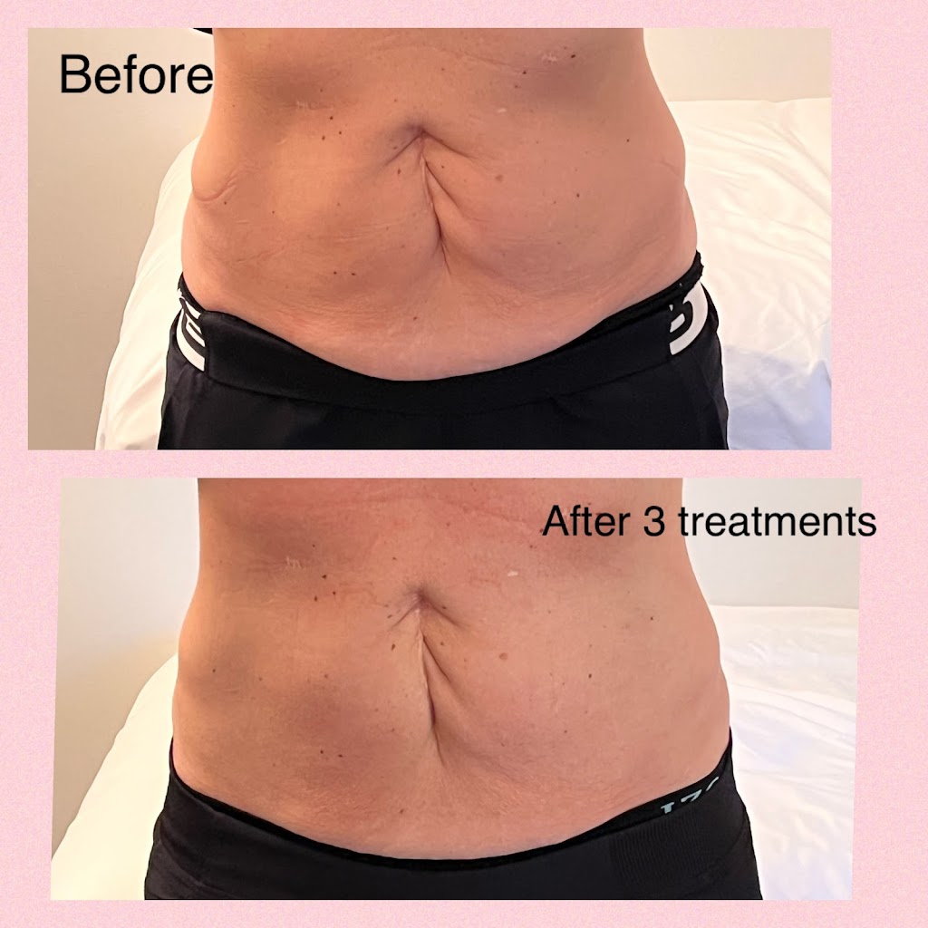 Flawlessly Sculpted Bodies by Patti | 132 St George St, St Thomas, ON N5P 2M1, Canada | Phone: (519) 719-6161