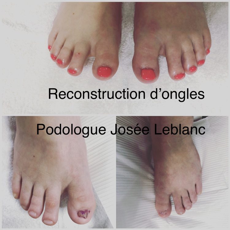 Soin de pied en beauté | 300 Rue Valmont Local 202, Repentigny, QC J5Y 3X6, Canada | Phone: (514) 583-6468